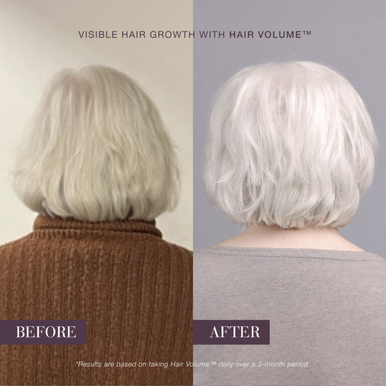 Plaukų nuotraukos „prieš“ ir „po“ – po „New Nordic Hair Volume™“ naudojimo plaukai atrodo gausesni ir blizgesni.